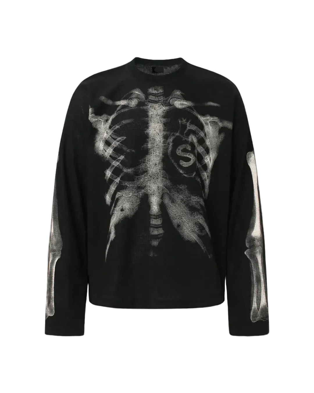 'XRAY' THERMAL