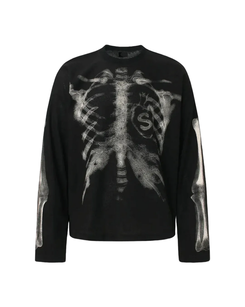 'XRAY' THERMAL